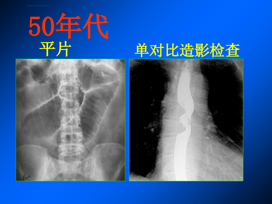 胃肠道影像检查技术的发展课件_第2页