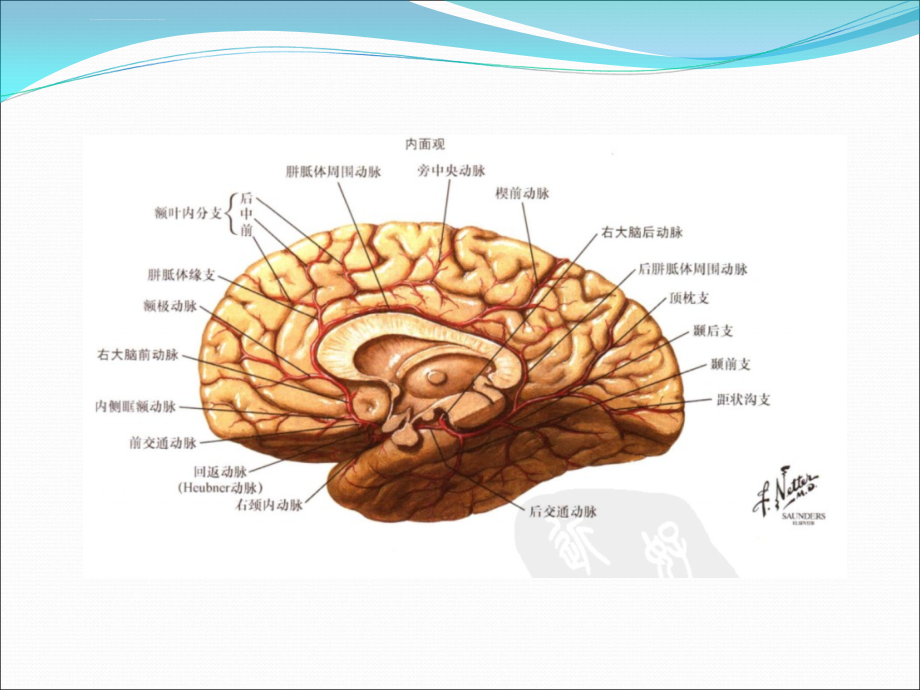 脑梗死责任血管分析课件_第3页