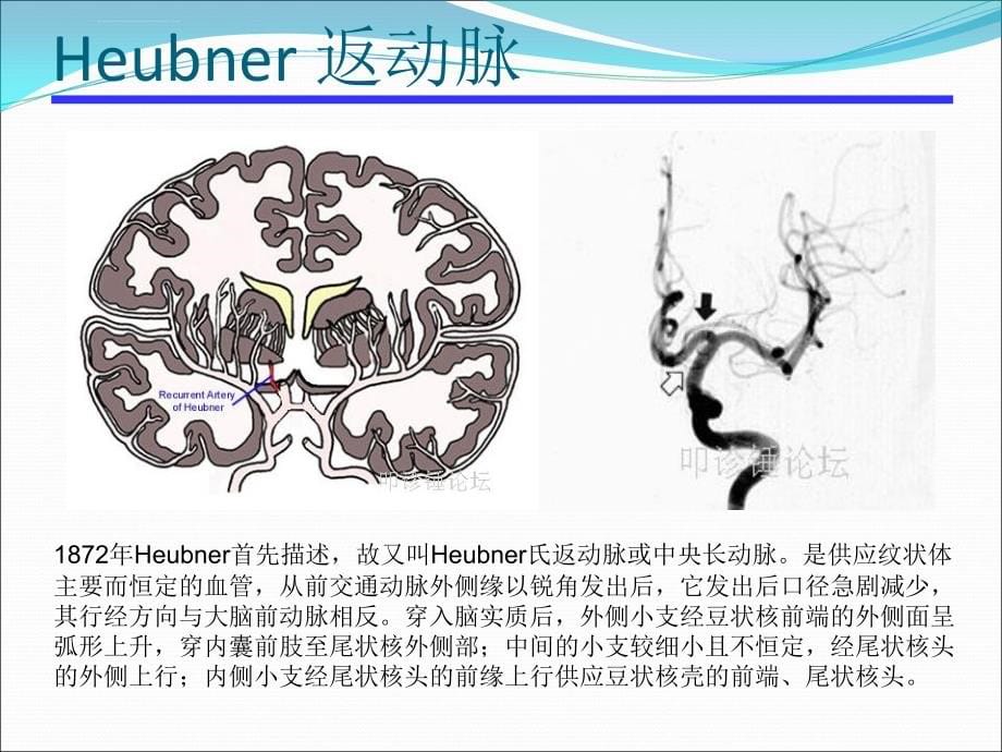 脑梗死责任血管分析课件_第5页