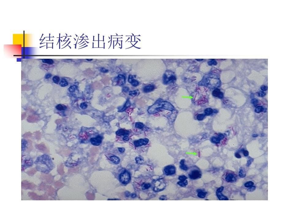 实验九传染病与寄生虫病课件_第5页