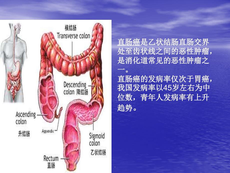 直肠癌的护理教学查房课件_第3页