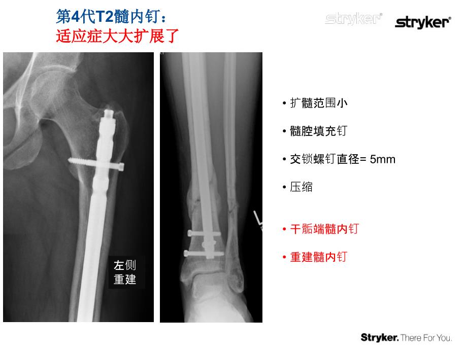 t2-临床培训课件_第4页