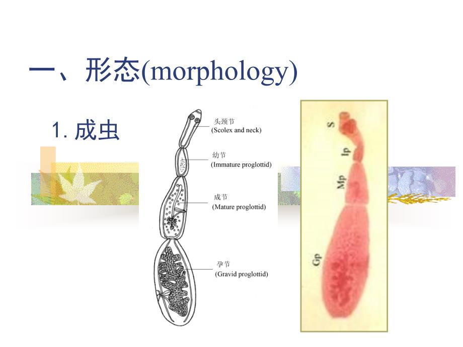 细粒棘球绦虫课件_第2页