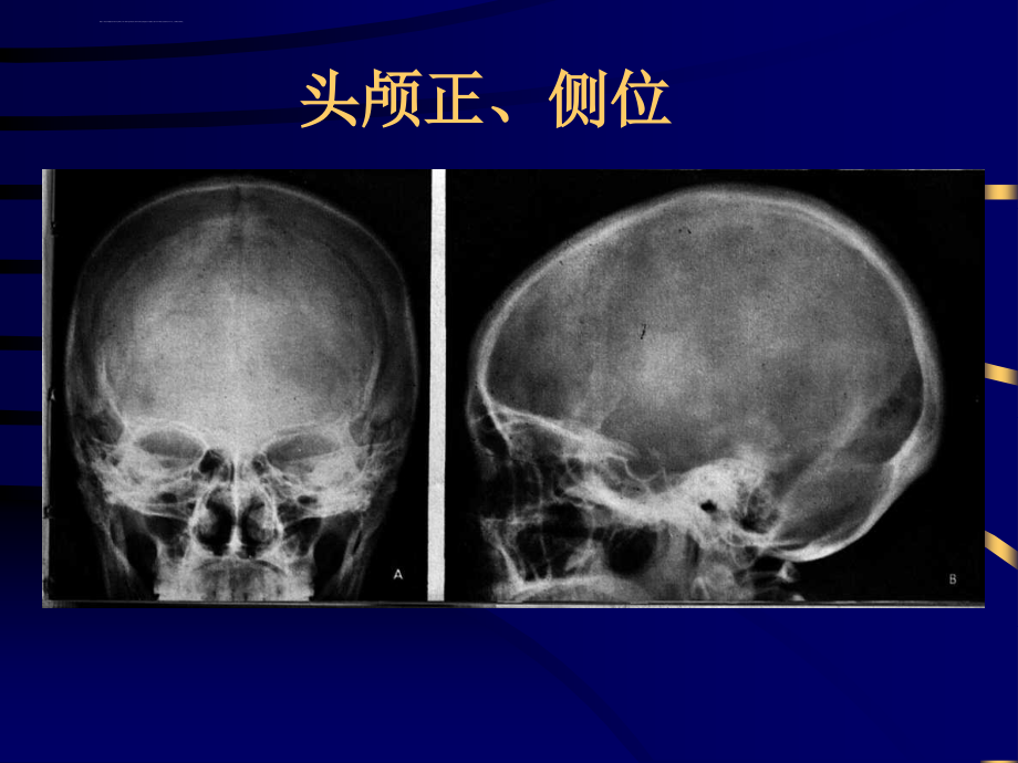 医学课件中枢神经系统_第3页