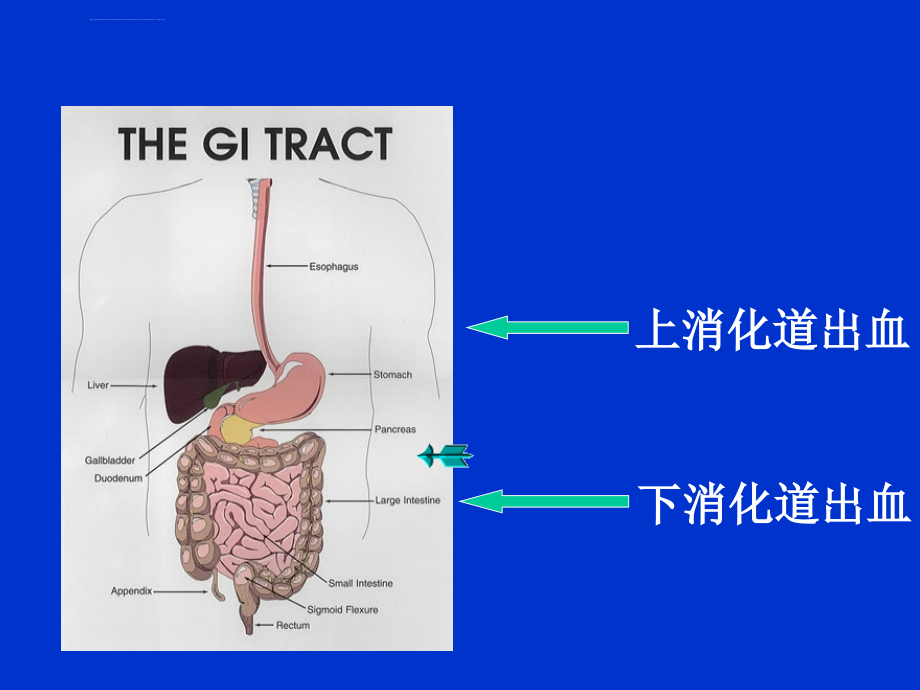 上消化道出血课件_1_第2页