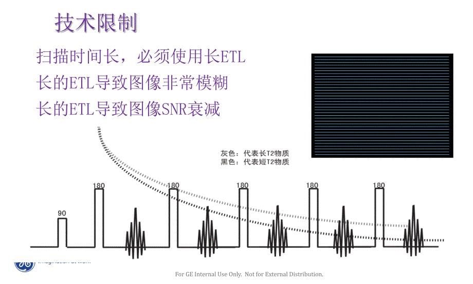 signa15t新技术介绍课件_第5页