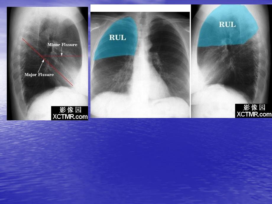 线解剖课件_第4页