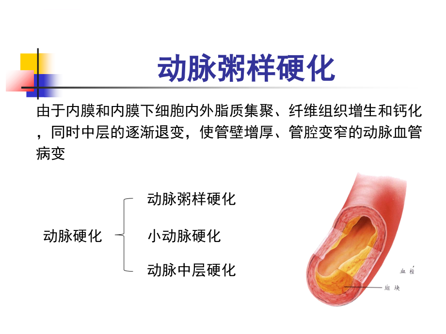 冠状动脉粥样硬化性心脏病概论课件_第3页