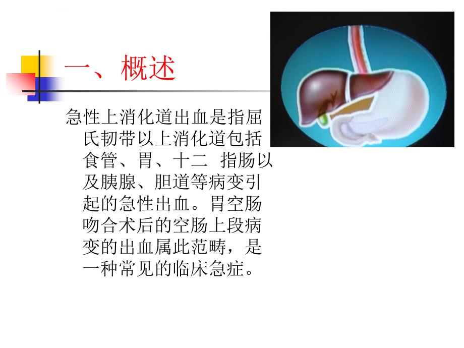 急性上消出血诊治（课件）_第2页