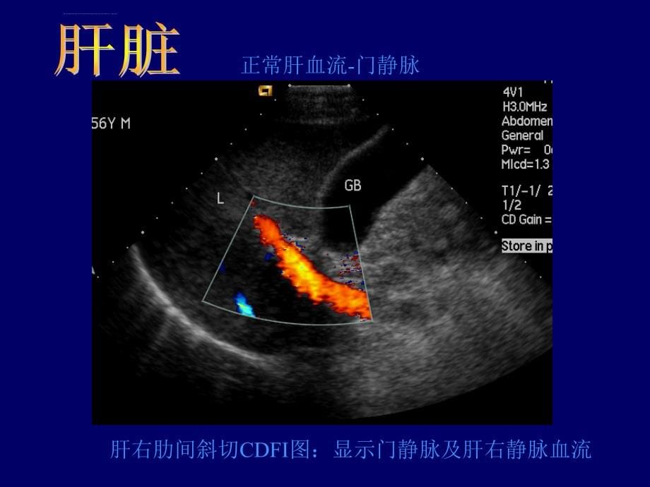 影像b超图谱课件_第5页