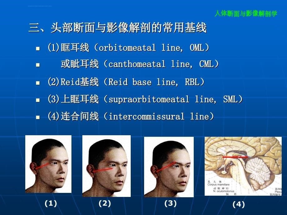 人体断面与影像解剖学头部pp课件_第5页