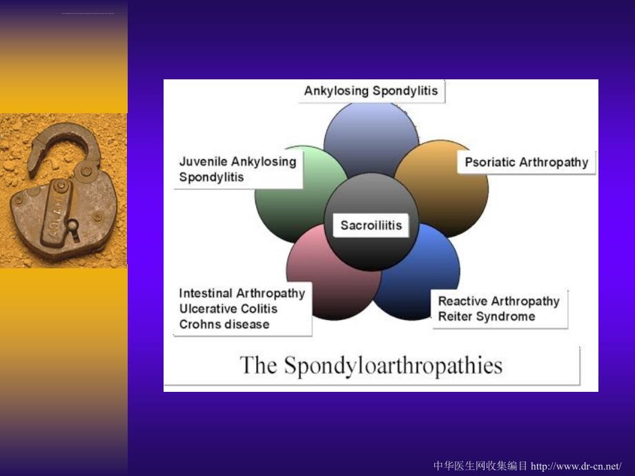 强直性脊柱炎诊治进展课件_第3页