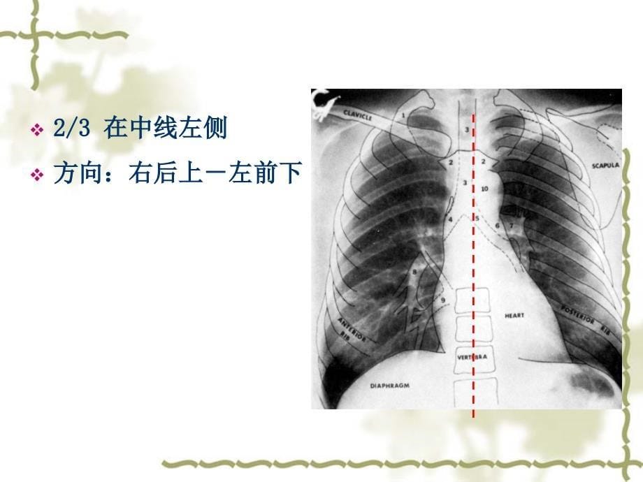 心脏基础解剖课件_第5页