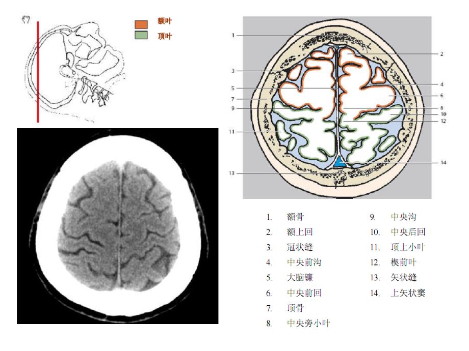 头颈ctmri解剖图解第一季_第2页