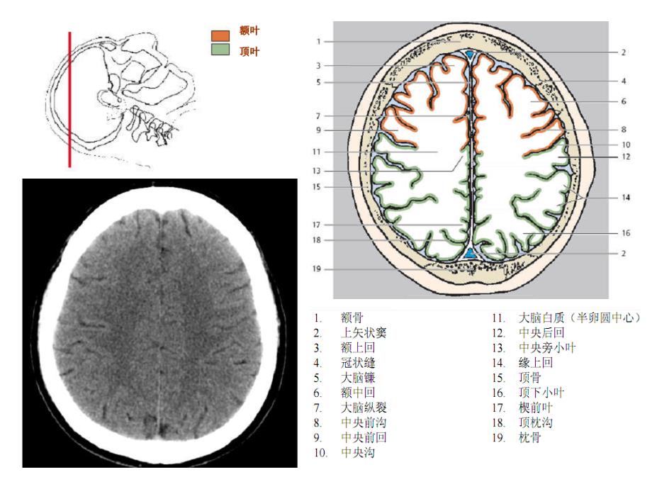 头颈ctmri解剖图解第一季_第3页