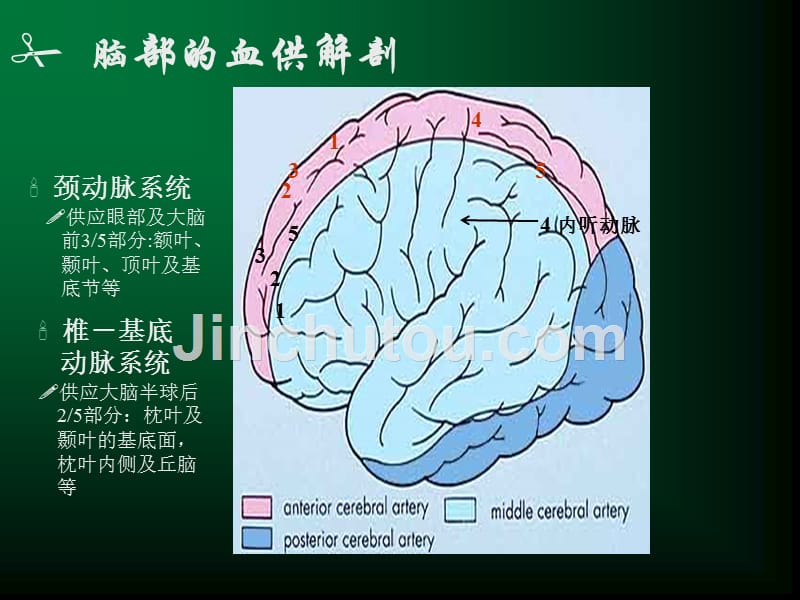 脑血管疾病课件_2_第4页