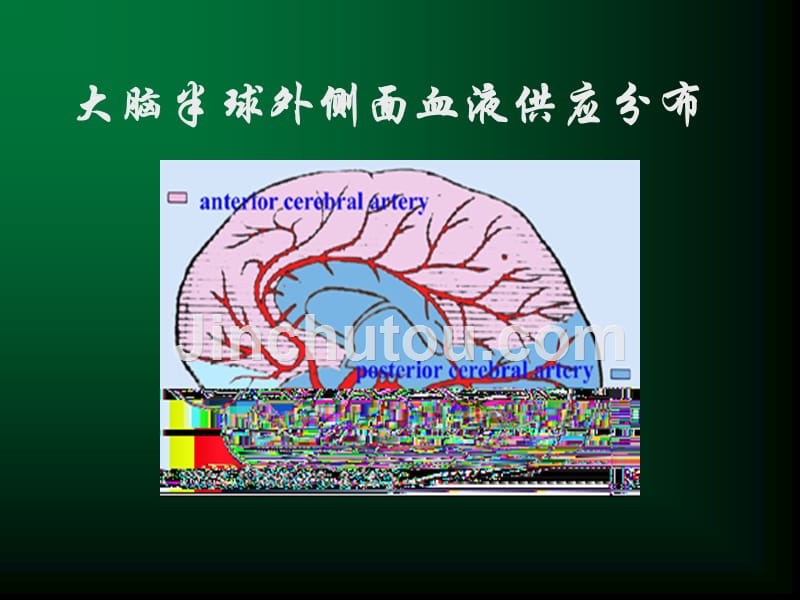 脑血管疾病课件_2_第5页