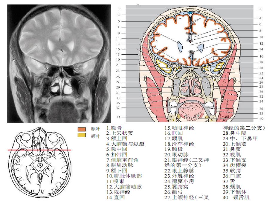 头颈ctmri解剖图解第四季_第4页