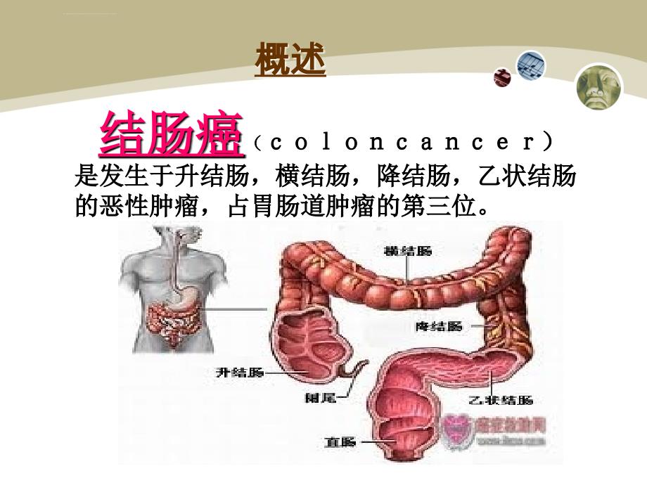 结肠癌护理查房肿瘤内科课件_第3页