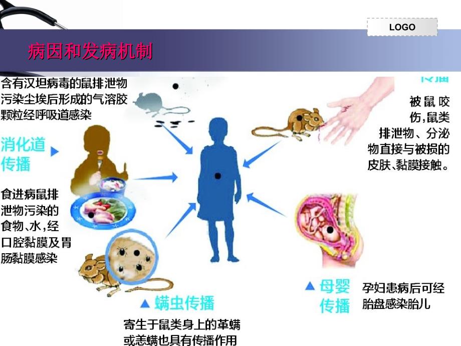 流行性出血热个案护理课件_第4页