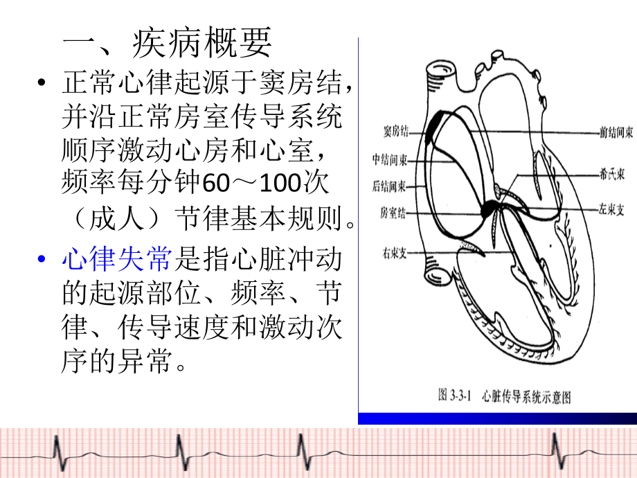 心律失常病人护理课件_第2页