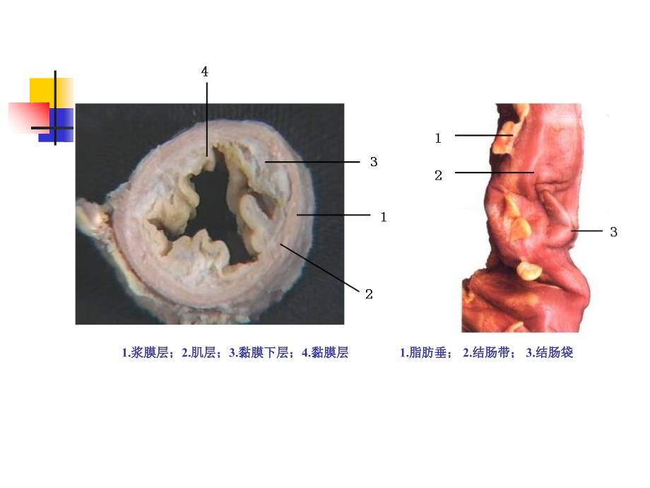 结肠直肠肛管疾病课件_第3页