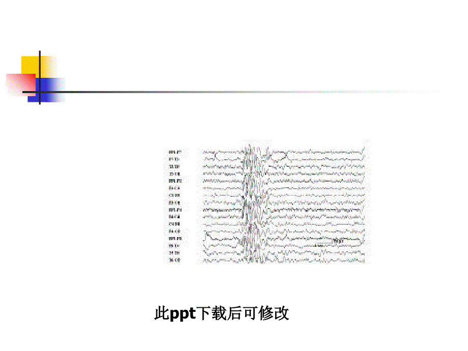 癫痫的治疗_第2页