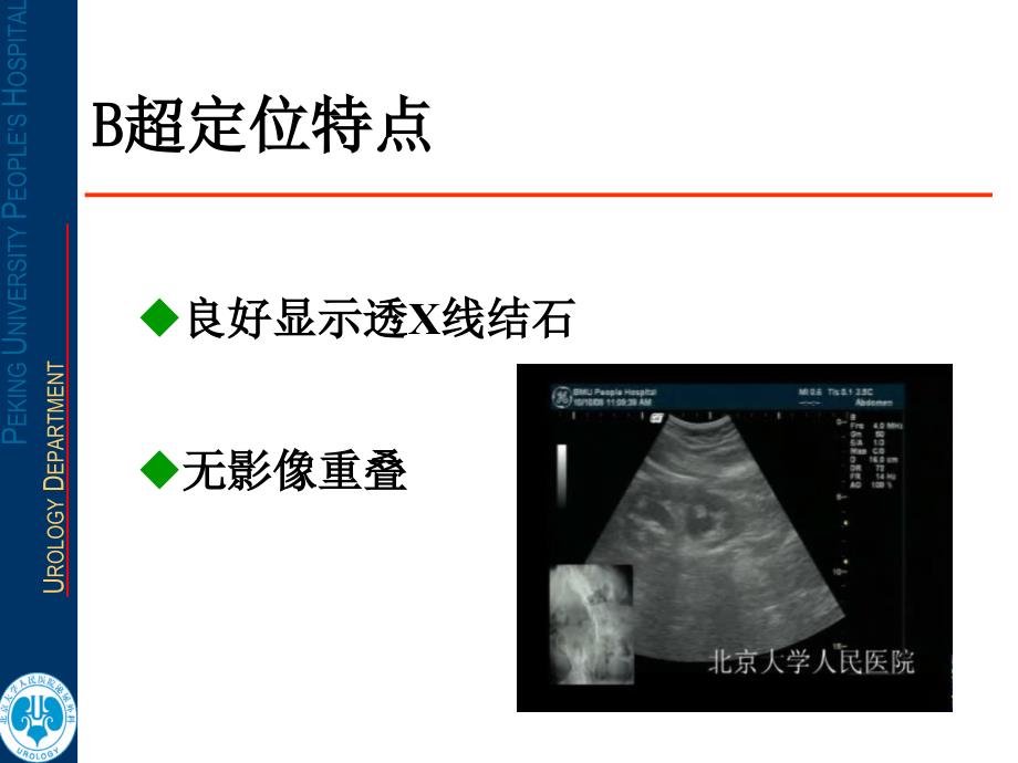 超声定位若干问题超声定位经皮肾镜技术需要注意的若干问题_第3页