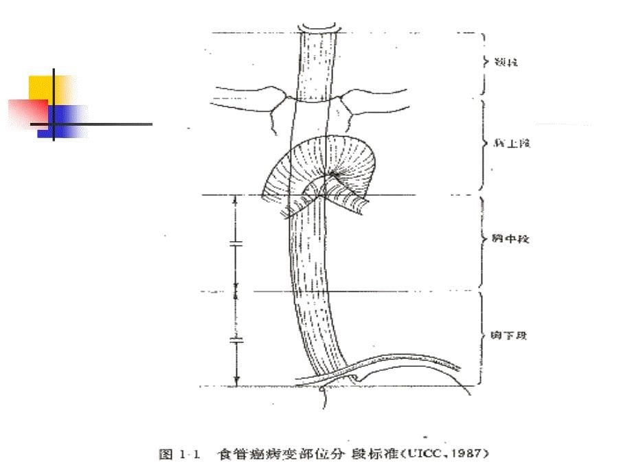 食管癌的治疗王仁本_第5页