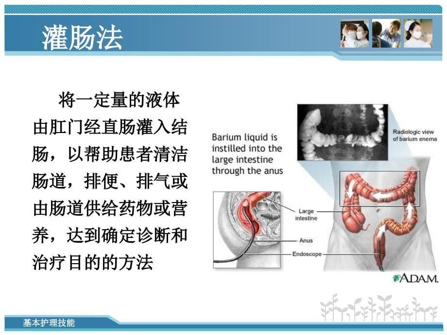 排便的护理——模块6饮食与排泄护理技术_第5页