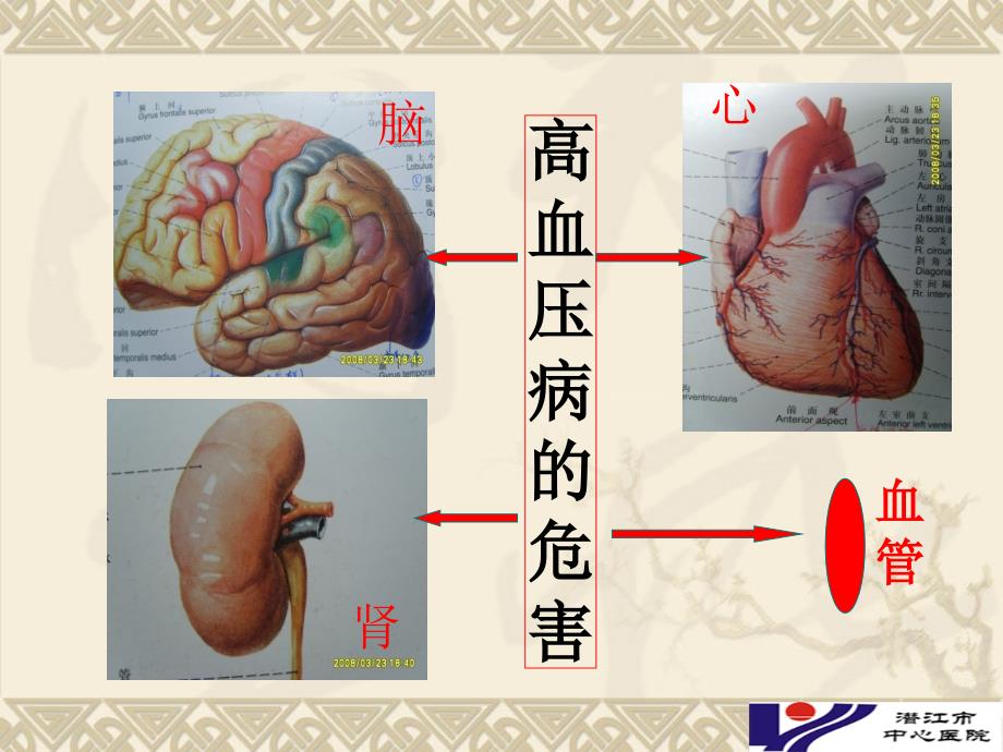 高血压病的防治原则及措施_第4页