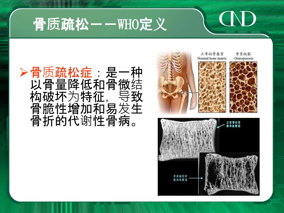 骨科常见病恒江联盟_第3页