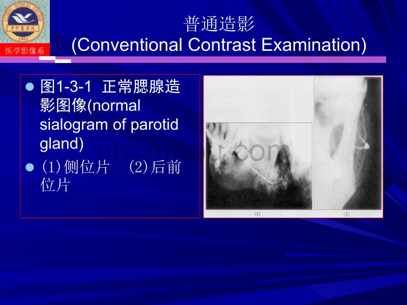 涎腺疾病与颞下颌关节疾病影像诊断唐光才_第3页