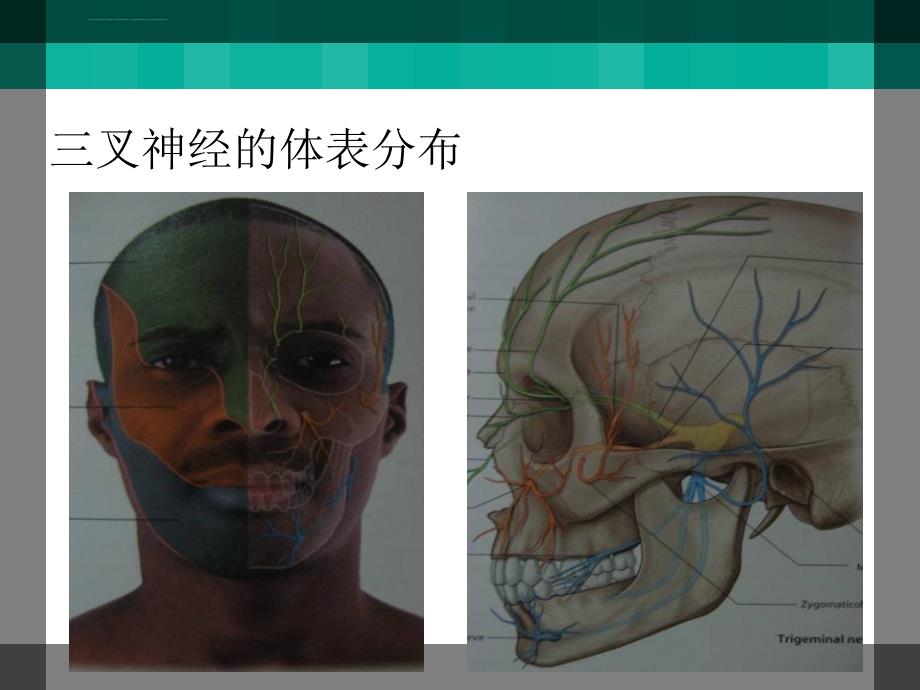 三叉神经痛射频治疗经过与并发症的处理ppt培训课件_第4页