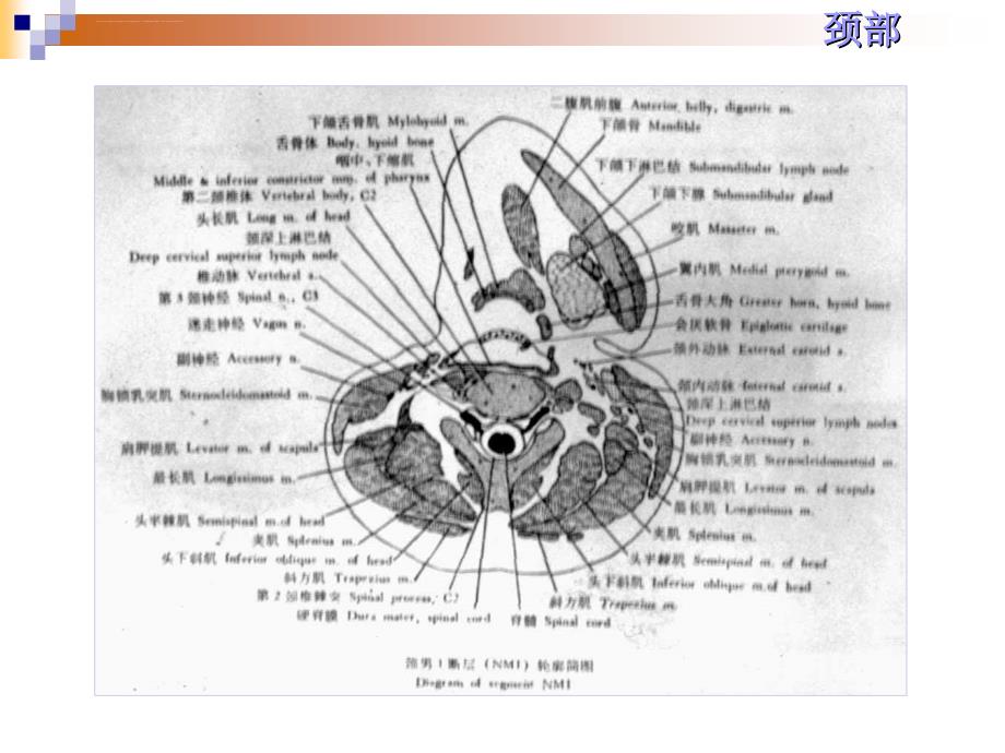 人体解剖断层颈部（断面）ppt培训课件_第2页