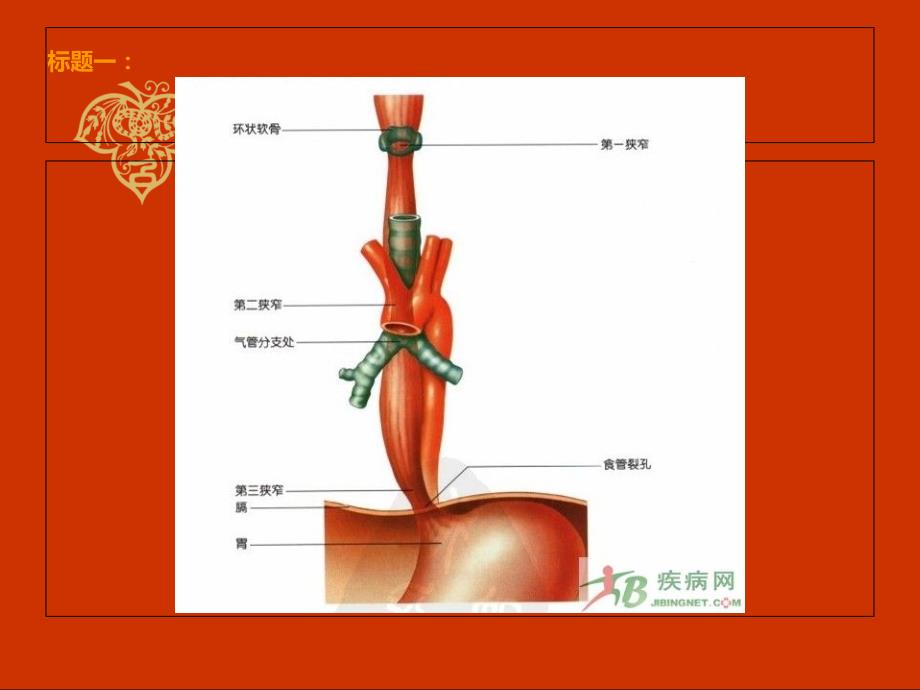 内镜下的治疗幻灯片_第3页