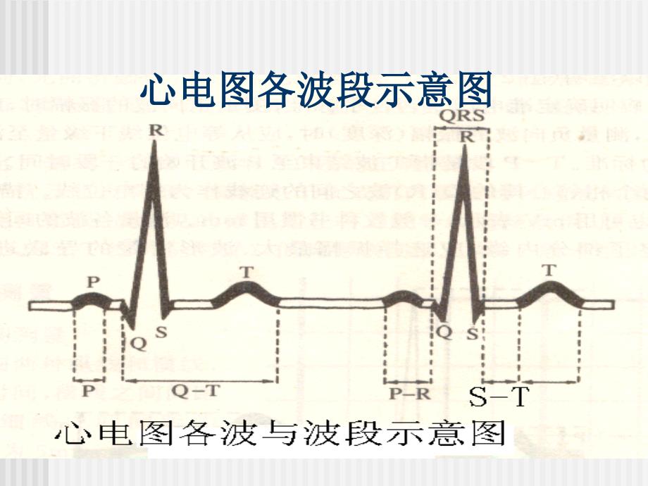 心电图的基础知识及常见异常心电图识别ppt课件_第2页