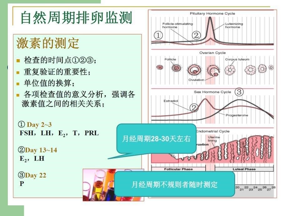 生殖激素化验单解读谢秀琴_第5页