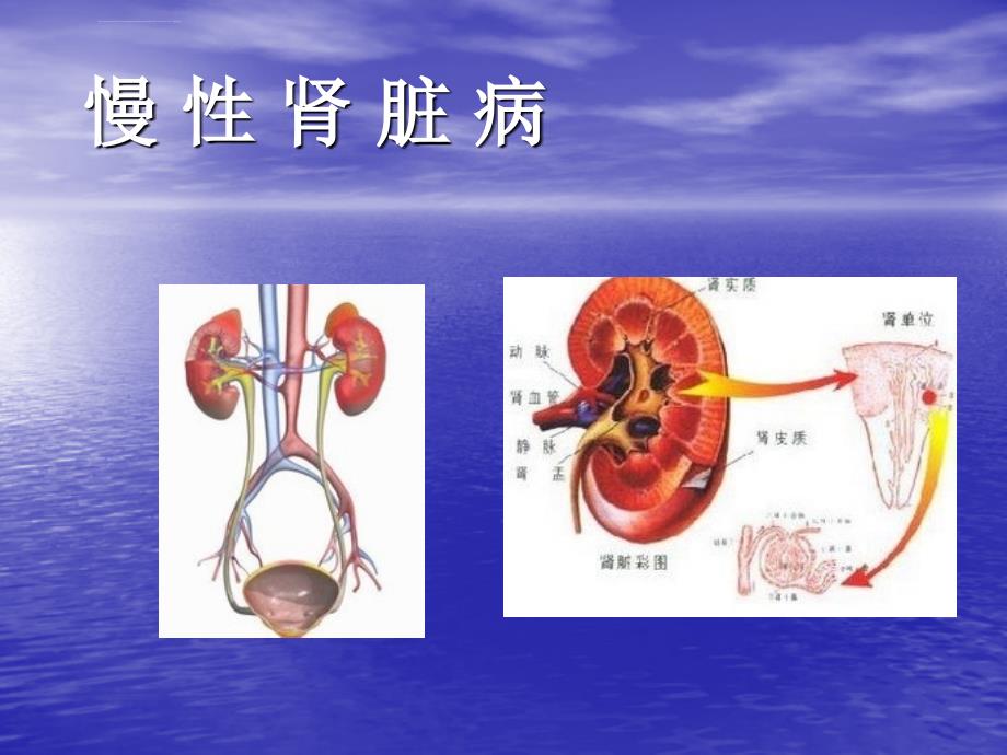 慢性肾脏病ppt课件_第1页