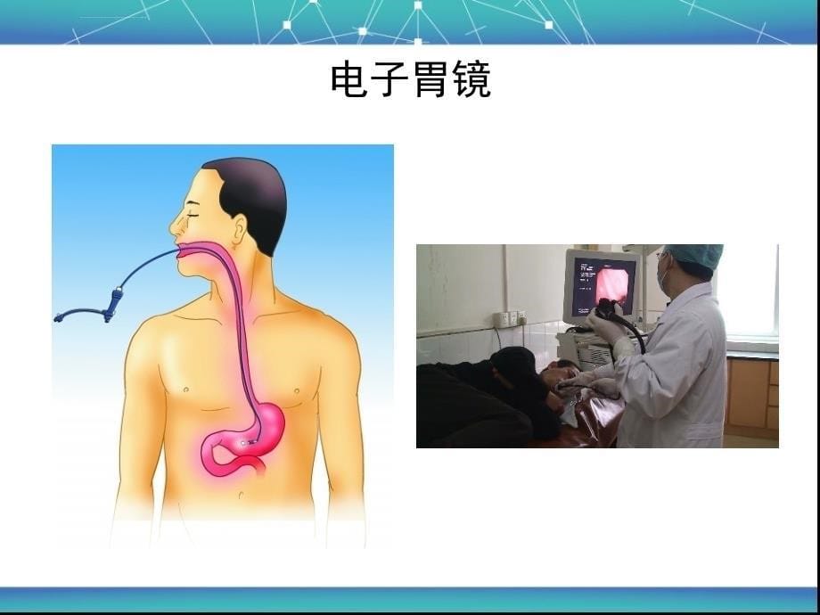 消化内镜操作、诊断及治疗ppt培训课件_第5页