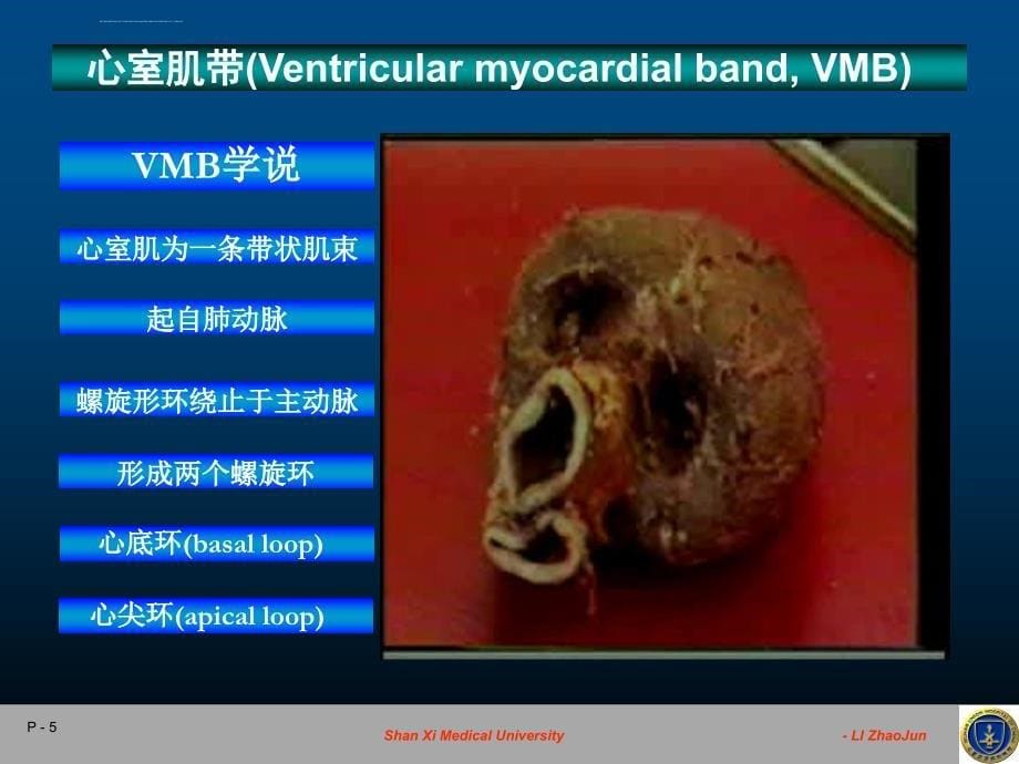 心肌解剖力学与超声评价-课件，幻灯_第5页