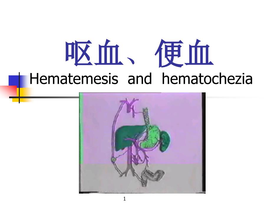 呕血便血意识障碍_第1页