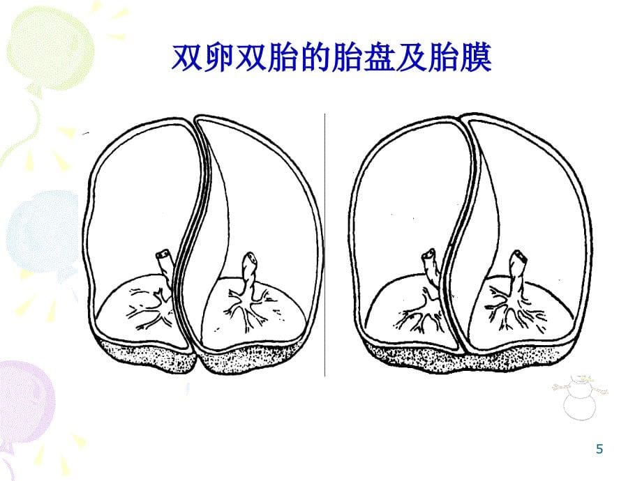 多胎妊娠与巨大胎儿-教学课件，幻灯，_第5页