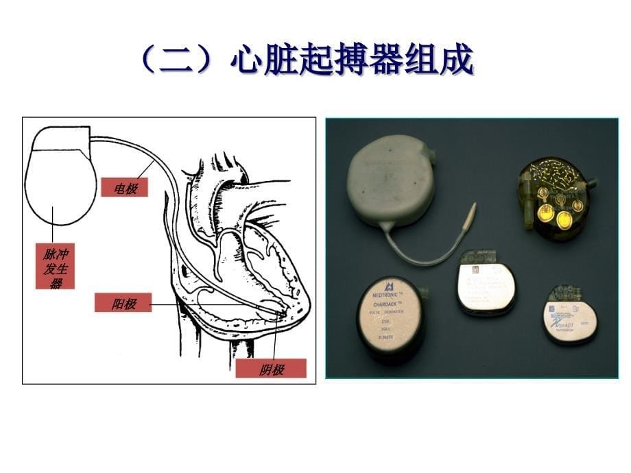 循环系统常用诊疗技术及护理ppt培训课件_第5页