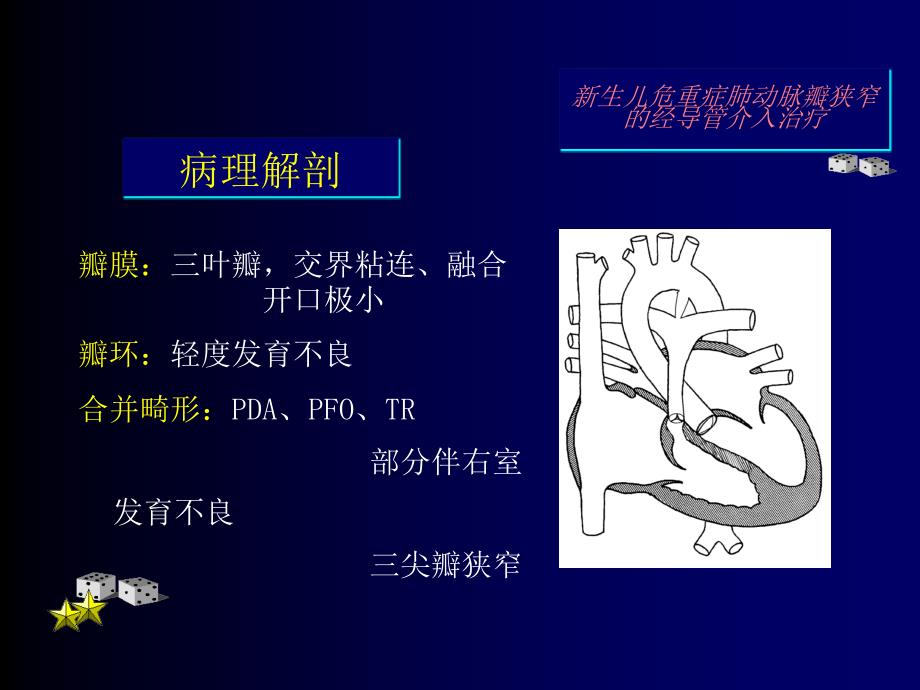 新生儿危重症肺动脉瓣狭窄的经导管介入治疗_第2页