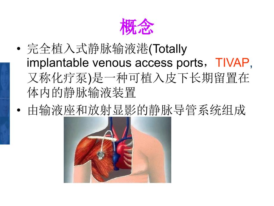 植入式静脉输液港的护理ppt课件_第2页