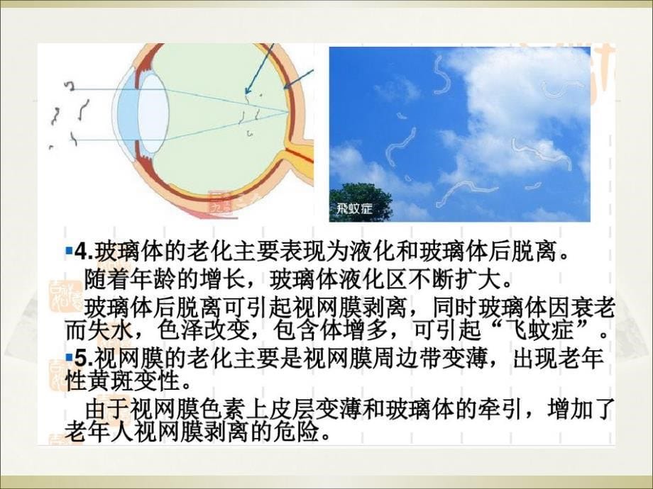 老年白内障护理ppt课件_第5页