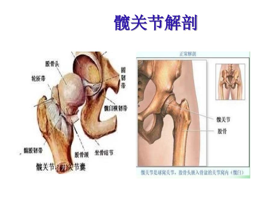 髋关节置换术后护理ppt课件_第3页