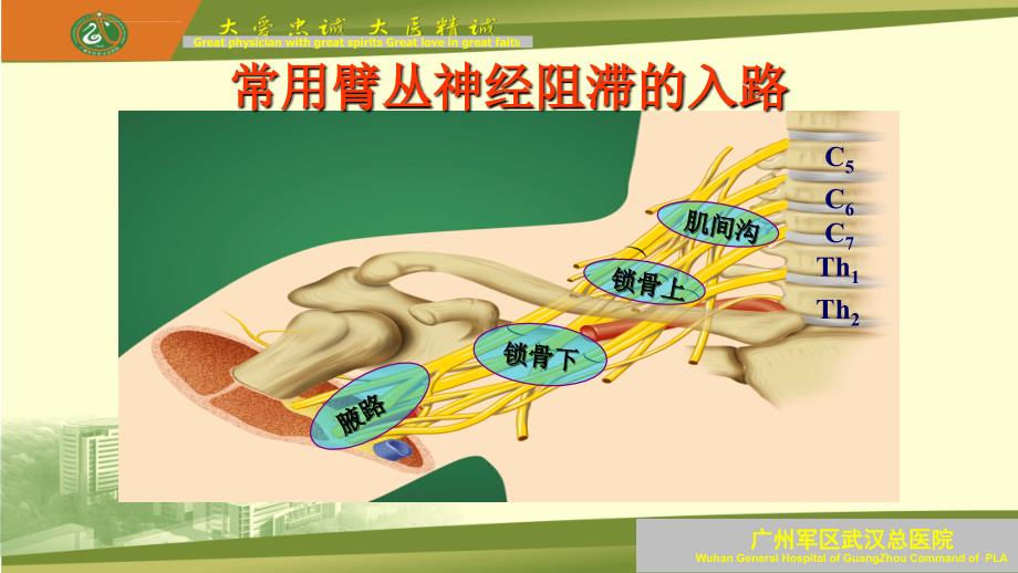 臂丛神经阻滞及临床问题探讨ppt课件_第4页