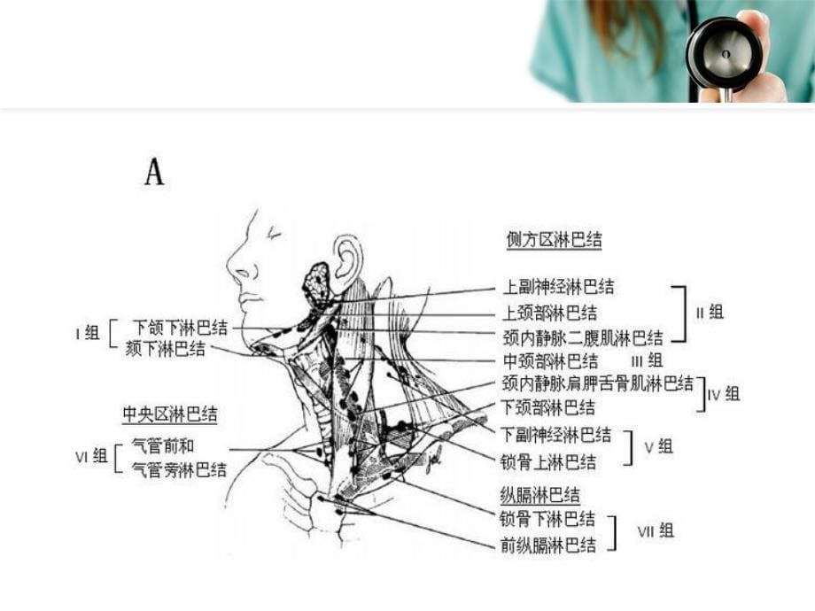 髓样甲状腺癌伴淋巴结转移的手术攻略ppt课件_第5页